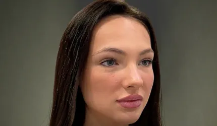 Before Hair Mesotherapy