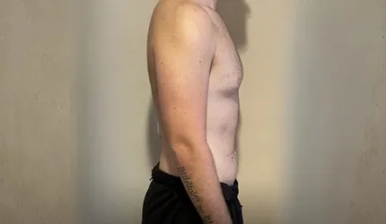 Before Body Slimming