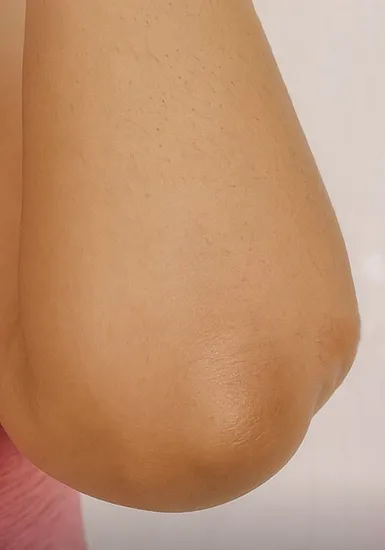 After Body Skin Booster